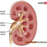 ۱۴ توصیه کلیوی در این سایت